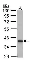 Anti-GRHPR antibody [N1C3] used in Western Blot (WB). GTX109575