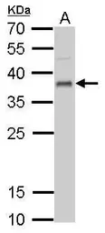 Anti-UFD1L antibody used in Western Blot (WB). GTX109579