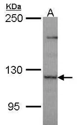 Anti-PLEKHG4 antibody [N1N2], N-term used in Western Blot (WB). GTX109584