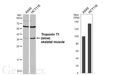 Anti-Troponin T1 (slow) skeletal muscle antibody used in Western Blot (WB). GTX109585