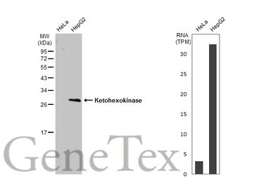 Anti-Ketohexokinase antibody [N1C3] used in Western Blot (WB). GTX109591