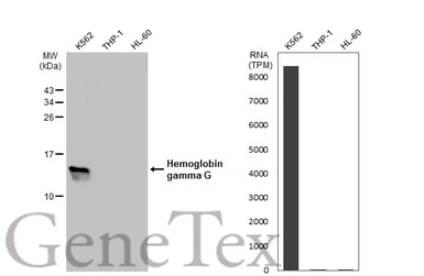 Anti-Hemoglobin gamma G antibody used in Western Blot (WB). GTX109601