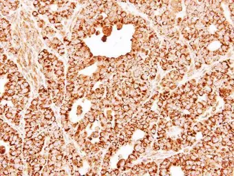 Anti-DECR1 antibody [N1C3] used in IHC (Paraffin sections) (IHC-P). GTX109608