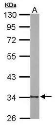 Anti-DECR1 antibody [N1C3] used in Western Blot (WB). GTX109608