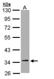 Anti-DECR1 antibody [N1C3] used in Western Blot (WB). GTX109608