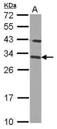 Anti-CHMP2B antibody used in Western Blot (WB). GTX109610