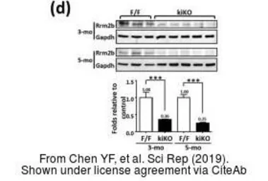 Anti-p53R2 antibody [N1C3] used in Western Blot (WB). GTX109620