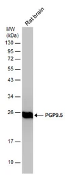 Anti-PGP9.5 antibody used in Western Blot (WB). GTX109637