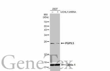 Anti-PGP9.5 antibody used in Western Blot (WB). GTX109637