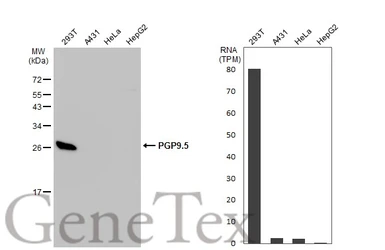 Anti-PGP9.5 antibody used in Western Blot (WB). GTX109637