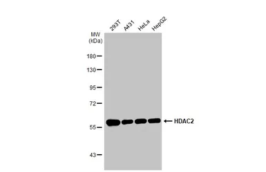 Anti-HDAC2 antibody used in Western Blot (WB). GTX109642
