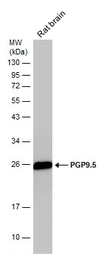 Anti-PGP9.5 antibody used in Western Blot (WB). GTX109646