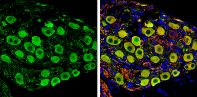 Anti-PGP9.5 antibody used in IHC (Paraffin sections) (IHC-P). GTX109646