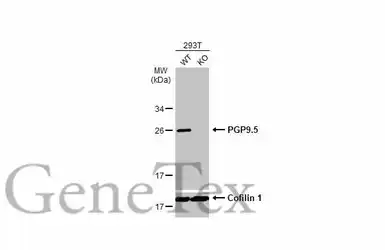 Anti-PGP9.5 antibody used in Western Blot (WB). GTX109646