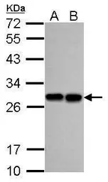 Anti-PGP9.5 antibody used in Western Blot (WB). GTX109646