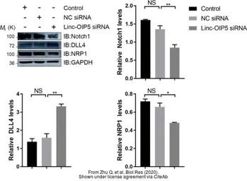 Anti-DLL4 antibody [N1N2], N-term used in Western Blot (WB). GTX109649