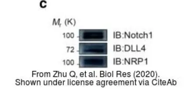 Anti-DLL4 antibody [N1N2], N-term used in Western Blot (WB). GTX109649