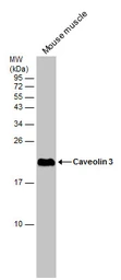 Anti-Caveolin 3 antibody [N1N2], N-term used in Western Blot (WB). GTX109650