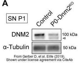 Anti-Dynamin 2 antibody [C2C3], C-term used in Western Blot (WB). GTX109652