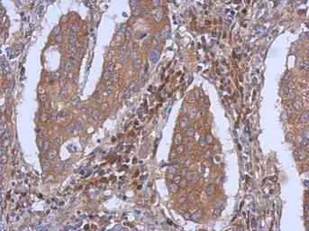 Anti-Dynamin 2 antibody [C2C3], C-term used in IHC (Paraffin sections) (IHC-P). GTX109652