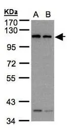 Anti-Dynamin 2 antibody [C2C3], C-term used in Western Blot (WB). GTX109652