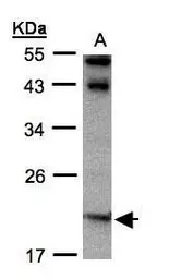 Anti-IL22 antibody used in Western Blot (WB). GTX109659
