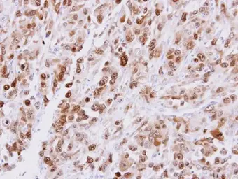 Anti-CDT1 antibody used in IHC (Paraffin sections) (IHC-P). GTX109663