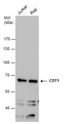 Anti-CDT1 antibody used in Western Blot (WB). GTX109663