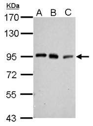 Anti-PCAF antibody [C3], C-term used in Western Blot (WB). GTX109666