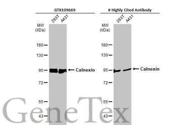Anti-Calnexin antibody [C3], C-term used in Western Blot (WB). GTX109669