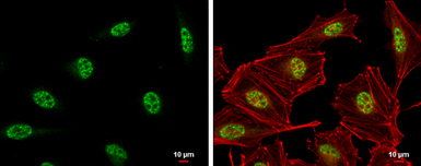 Anti-DNA-PKcs antibody [C3], C-term used in Immunocytochemistry/ Immunofluorescence (ICC/IF). GTX109673