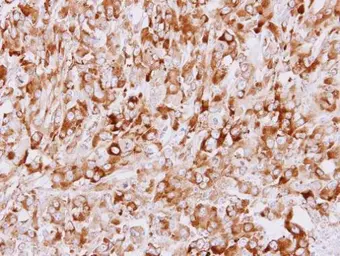 Anti-STUB1 antibody [C1C3] used in IHC (Paraffin sections) (IHC-P). GTX109676