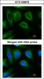 Anti-STUB1 antibody [C1C3] used in Immunocytochemistry/ Immunofluorescence (ICC/IF). GTX109676