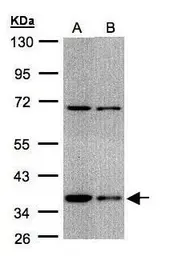 Anti-STUB1 antibody [C1C3] used in Western Blot (WB). GTX109676