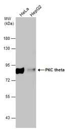 Anti-PKC theta antibody used in Western Blot (WB). GTX109690