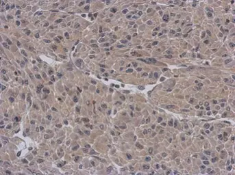 Anti-APBB3 antibody [N3C3] used in IHC (Paraffin sections) (IHC-P). GTX109699