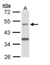 Anti-APBB3 antibody [N3C3] used in Western Blot (WB). GTX109699