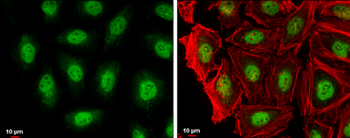 Anti-RAG2 antibody used in Immunocytochemistry/ Immunofluorescence (ICC/IF). GTX109710