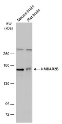 Anti-NMDAR2B antibody [C2C3], C-term used in Western Blot (WB). GTX109713
