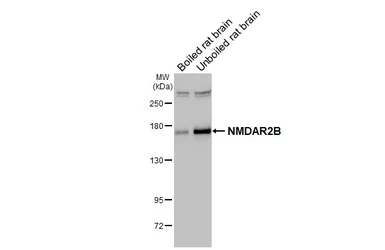 Anti-NMDAR2B antibody [C2C3], C-term used in Western Blot (WB). GTX109713