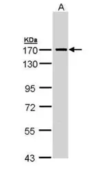 Anti-SMC1A antibody [N1N2], N-term used in Western Blot (WB). GTX109724