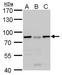 Anti-DDX3 antibody used in Western Blot (WB). GTX109727