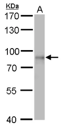 Anti-DDX3 antibody used in Western Blot (WB). GTX109727