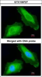 Anti-DDX3 antibody used in Immunocytochemistry/ Immunofluorescence (ICC/IF). GTX109727