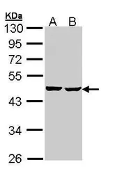 Anti-SUCLA2 antibody [N2C3] used in Western Blot (WB). GTX109728