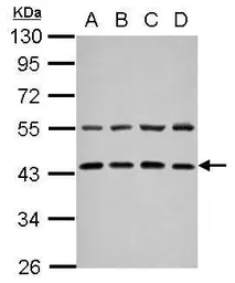 Anti-ZFYVE27 antibody [N3C3] used in Western Blot (WB). GTX109730