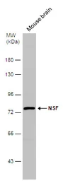Anti-NSF antibody [N3C3] used in Western Blot (WB). GTX109731