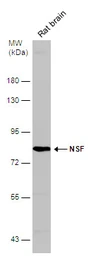 Anti-NSF antibody [N3C3] used in Western Blot (WB). GTX109731