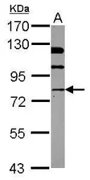 Anti-NSF antibody [N3C3] used in Western Blot (WB). GTX109731