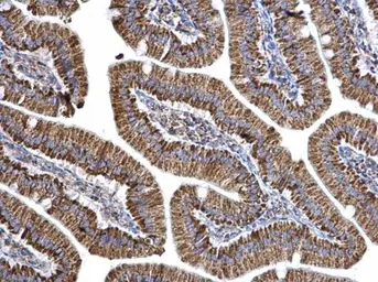 Anti-Aconitase 2 antibody [C1C3] used in IHC (Paraffin sections) (IHC-P). GTX109736